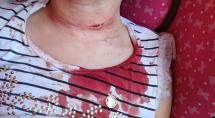 Menina de 3 anos tem corte no pescoço causado por linha chilena em Betim